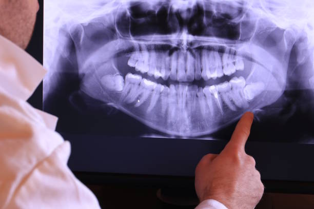 Best Urgent Dental Care for Toothache in South Monroe, MI