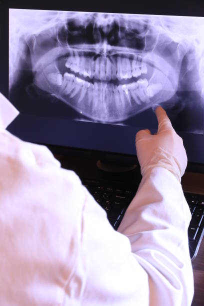 Best Emergency Dental Care for Abscessed Tooth in South Monroe, MI