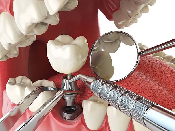 Best Weekend Emergency Dentist in South Monroe, MI